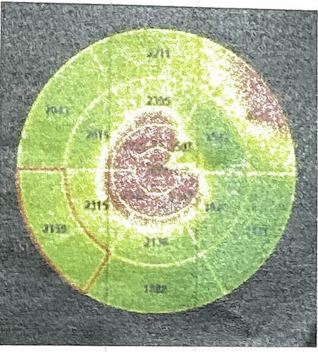 検査結果イメージ3